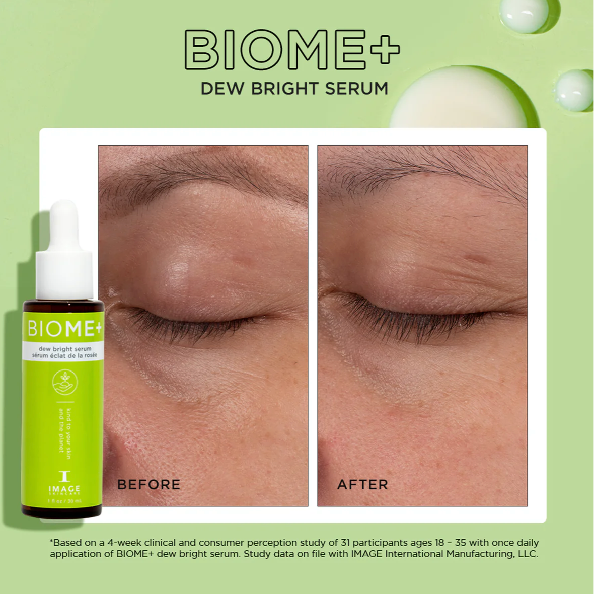 IMAGE Skincare, BIOME+ dew bright serum, SKINTES Switzerland